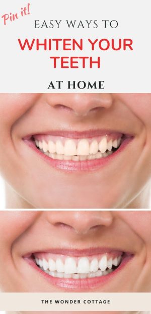 5 Home Remedies To Whiten Your Teeth Today - The Wonder Cottage