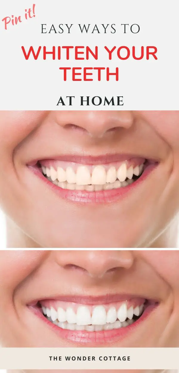 easy ways to whiten teeth