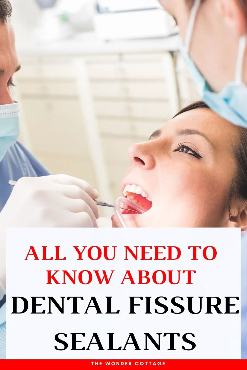 all you need to know about fissure sealants