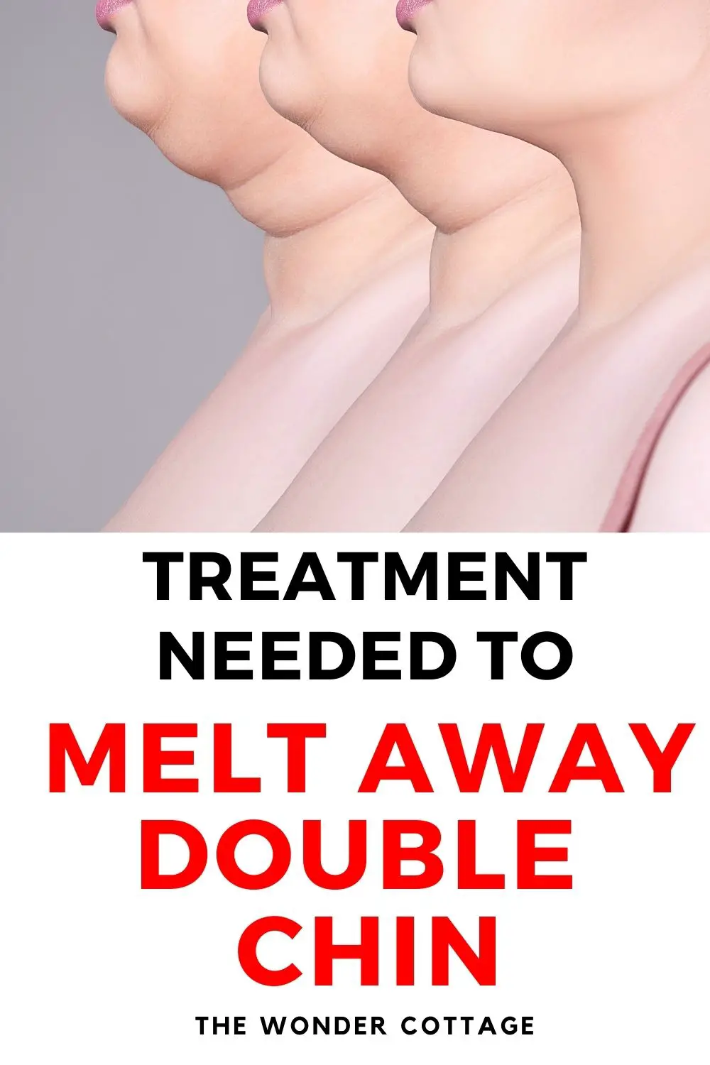 double chin treatment