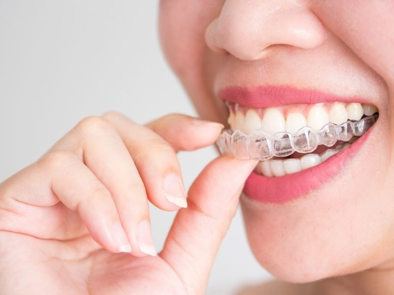 woman putting on an Invisalign braces