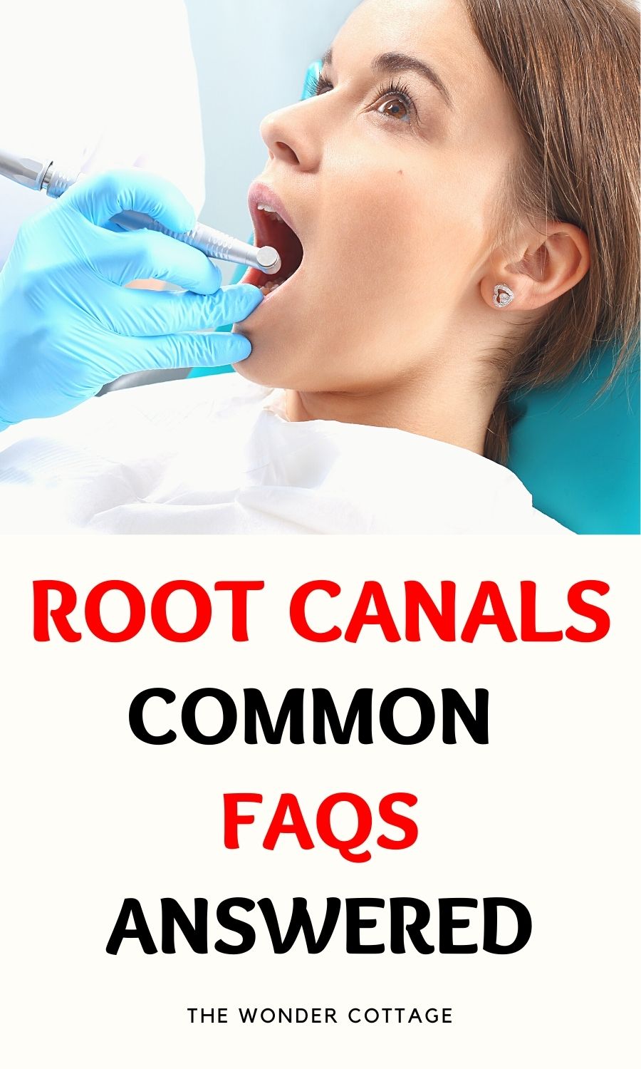 Root Canals, Common FAQs Answered